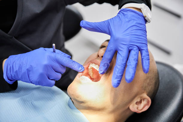 Best Emergency Treatment for Dental Infections or Abscesses in Lipatria, CA