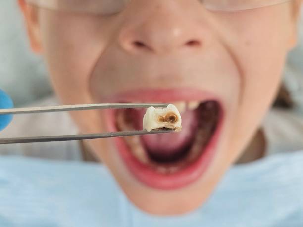 Best Cosmetic Emergency Dentistry in Lipatria, CA