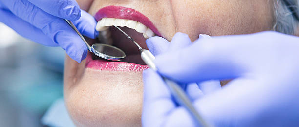 Best Urgent Care for Lost Fillings or Crowns in Lipatria, CA